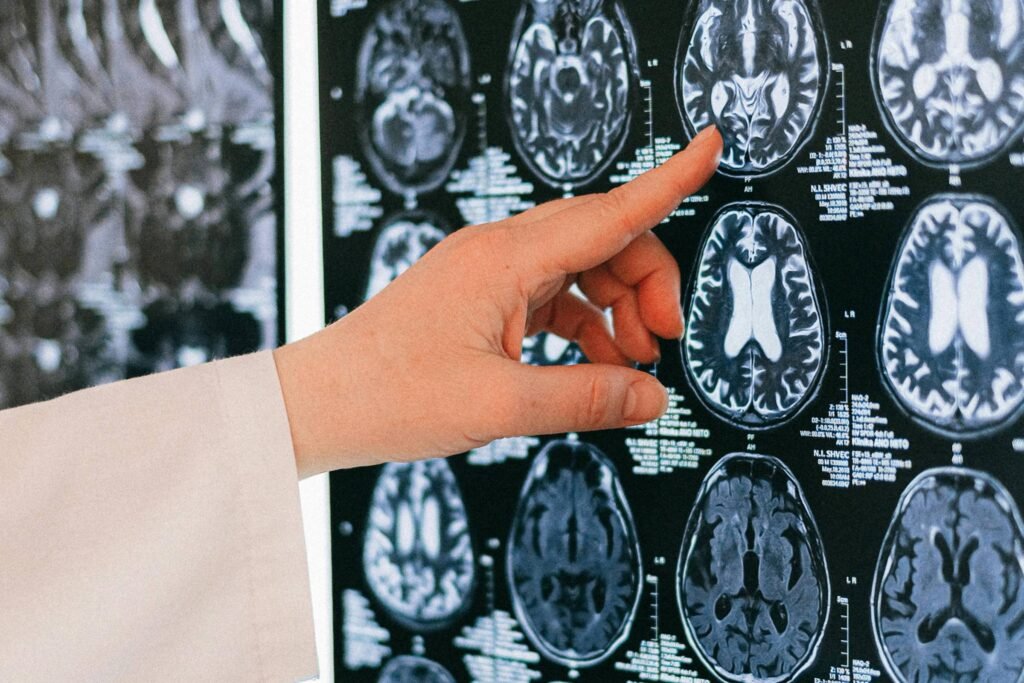 medico olhando ressonancia de um cerebro - metastase