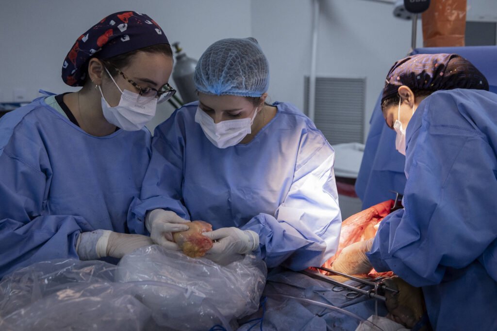 equipe de transplante